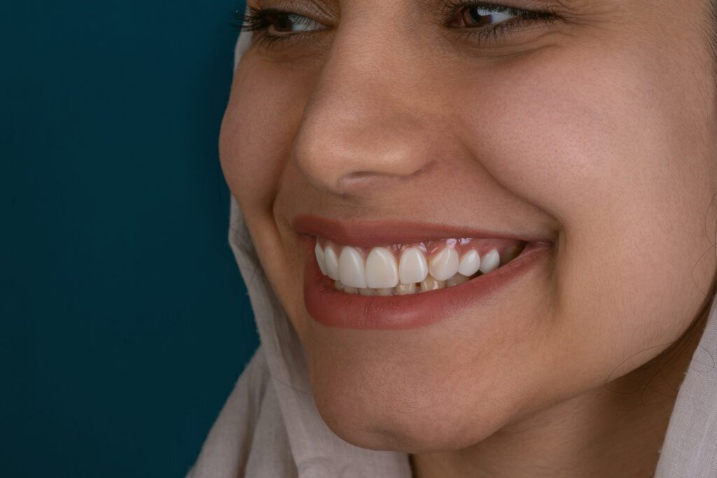 natural smile
