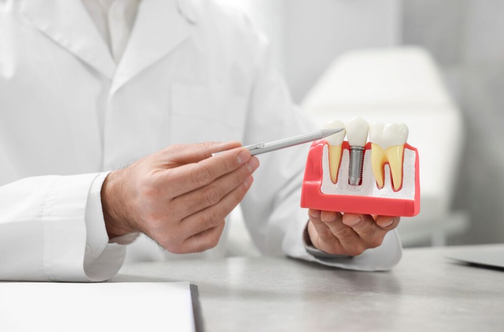 dental implant