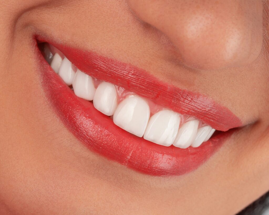 white teeth